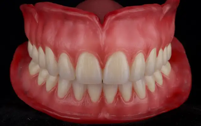 Free Complete Dentures63006659084801121