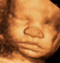 Own your own 3D/4D Ultrasound business