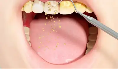 ** please read carefully ** Hi! I'm a dental hygiene student at Toronto College of Dental Hygiene an...