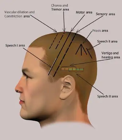 Pain control in minutes. HOPE for paralysis, hormone issues, View more