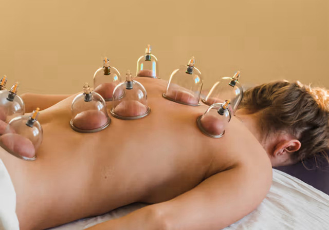 Massage combo with cupping and hot stone muscle release in Massage Services in Edmonton