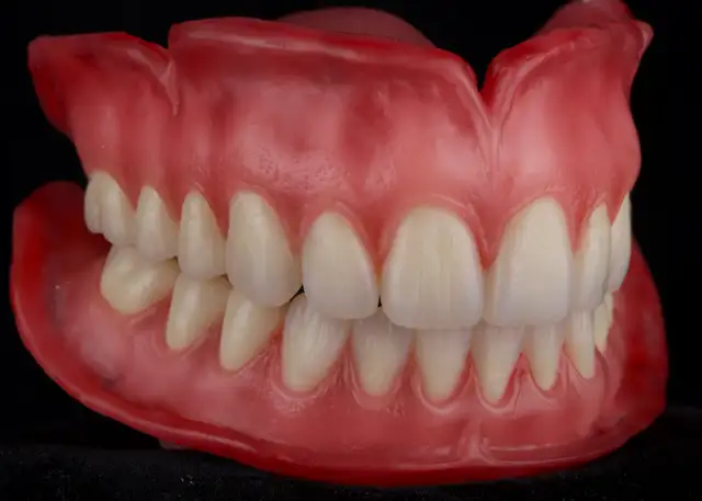 Free Complete Dentures63006659084801123
