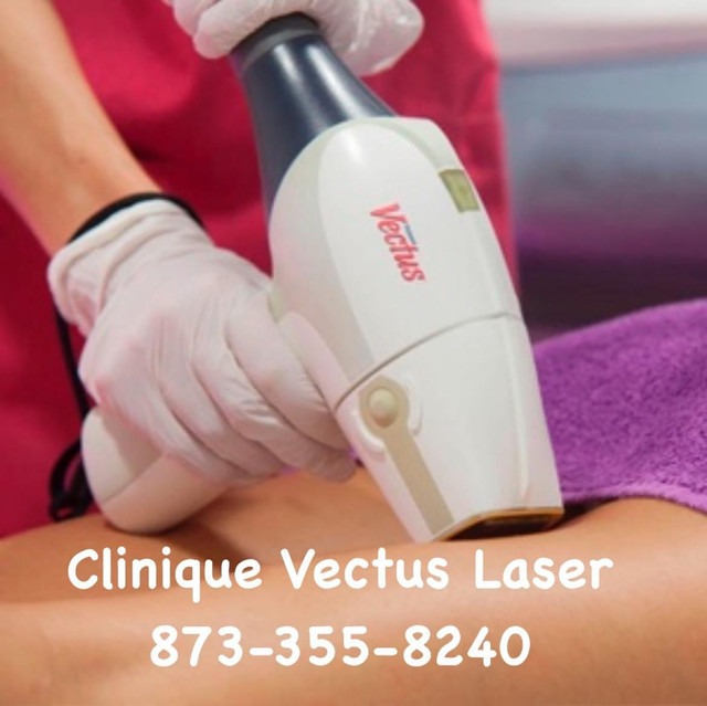 Laser hair removal / épilation laser Gatineau ottawa | Health and Beauty  Services | Gatineau | Kijiji