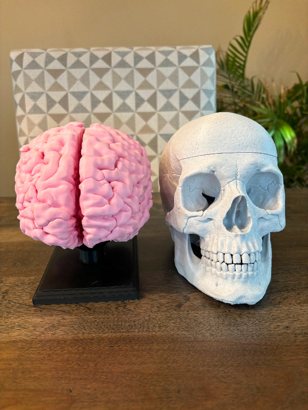 Human Brain (Full-size) & Human Skull (Anatomically Correct) in Arts & Collectibles in Ottawa - Image 2