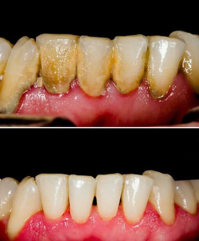 Free Dental Hygiene Care – Plus Bonus Incentives!  in Free Stuff in Mississauga / Peel Region - Image 4