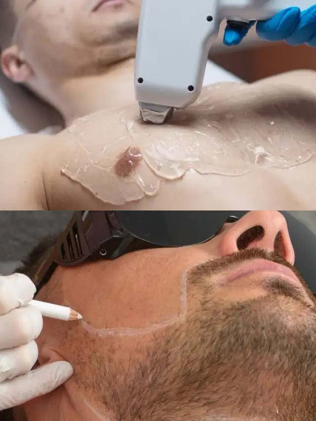 Waxing, Sugaring and Laser for women and men in Etobicoke in Health and Beauty Services in City of Toronto - Image 4
