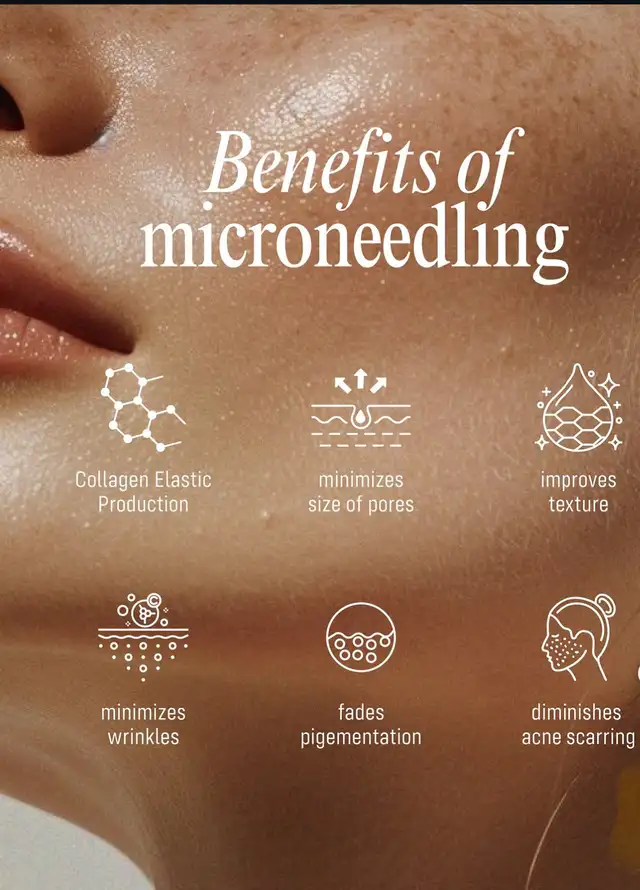 Microneedling with Exosomes & PDRN64623143300097120